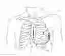 Fig. 01 - Multi-purpose medical tools and methods for gaining access to extravascular spaces in a patient