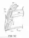 Fig. 06 - Multi-purpose medical tools and methods for gaining access to extravascular spaces in a patient
