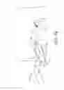 Fig. 08 - Multi-purpose medical tools and methods for gaining access to extravascular spaces in a patient
