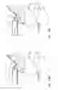Fig. 40 - Pericardial access device