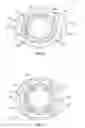 Fig. 06 - Orthopedic fixation devices and methods of installation thereof