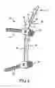 Fig. 04 - Spinal stabilization system