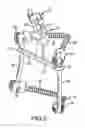 Fig. 06 - Spinal stabilization system