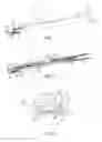Fig. 02 - Devices and methods for breaking and retaining surgical reduction tabs
