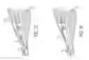 Fig. 14 - Devices and methods for breaking and retaining surgical reduction tabs
