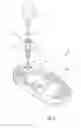 Fig. 02 - Medical device locking mechanisms and related methods and systems