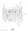 Fig. 07 - Medical device locking mechanisms and related methods and systems