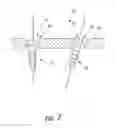 Fig. 08 - Medical device locking mechanisms and related methods and systems