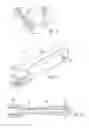 Fig. 04 - Medical device, apparatus, and surgical method