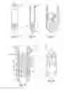 Fig. 05 - Medical device, apparatus, and surgical method