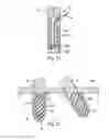 Fig. 09 - Method and device for producing an anchorage in human or animal tissue
