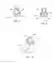 Fig. 05 - Instruments and methods for adjusting separation distance of vertebral bodies with a minimally invasive spinal stabilization procedure
