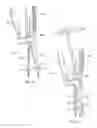 Fig. 13 - Instruments and methods for adjusting separation distance of vertebral bodies with a minimally invasive spinal stabilization procedure