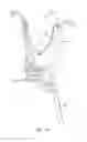 Fig. 14 - Instruments and methods for adjusting separation distance of vertebral bodies with a minimally invasive spinal stabilization procedure