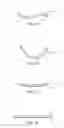 Fig. 18 - Instruments and methods for adjusting separation distance of vertebral bodies with a minimally invasive spinal stabilization procedure