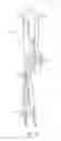 Fig. 20 - Instruments and methods for adjusting separation distance of vertebral bodies with a minimally invasive spinal stabilization procedure