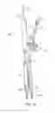 Fig. 24 - Instruments and methods for adjusting separation distance of vertebral bodies with a minimally invasive spinal stabilization procedure