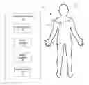 Fig. 01 - Screen sphere tissue ablation devices and methods