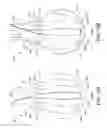 Fig. 22 - Screen sphere tissue ablation devices and methods