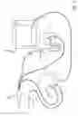 Fig. 05 - Electrosurgical Apparatus with Temperature Sensing and Methods of use thereof
