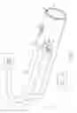 Fig. 03 - ELECTRICAL ABLATION DEVICES COMPRISING AN INJECTOR CATHETER ELECTRODE