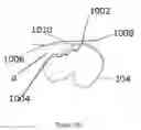 Fig. 14 - Systems, methods and devices for calculating hip center of rotation, adjusting parameters of joint replacement for pelvic tilt and calculating leg length and offset