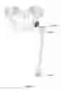 Fig. 24 - Systems, methods and devices for calculating hip center of rotation, adjusting parameters of joint replacement for pelvic tilt and calculating leg length and offset
