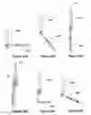 Fig. 34 - Single site robotic device and related systems and methods
