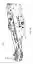 Fig. 13 - Catheter tension sensing