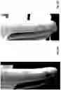 Fig. 03 - Leak resistant article