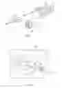 Fig. 02 - Illuminated ophthalmic cannula