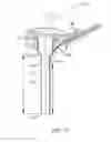 Fig. 15 - Illuminated ophthalmic cannula