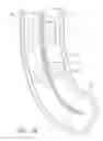 Fig. 20 - Body-inserted tube cleaning with suction