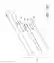Fig. 26 - Body-inserted tube cleaning with suction