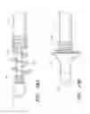 Fig. 30 - Body-inserted tube cleaning with suction