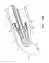 Fig. 33 - Body-inserted tube cleaning with suction