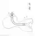 Fig. 44 - Body-inserted tube cleaning with suction