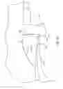 Fig. 23 - Dental matrix and dental matrix system