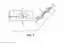 Fig. 04 - ORTHODONTIC PLATE FIXED TO MANDIBULAR RAMUS