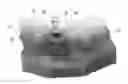 Fig. 01 - Reference member for determining a position of an implant analog