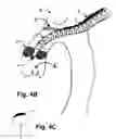 Fig. 07 - Method For Delivery Of An Embolic Protection Unit
