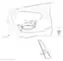 Fig. 02 - Trochlear resurfacing system and method