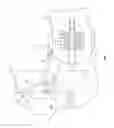 Fig. 08 - Trochlear resurfacing system and method