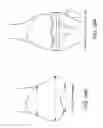 Fig. 35 - Patient-Adapted and Improved Orthopedic Implants, Designs and Related Tools