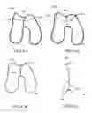 Fig. 49 - Patient-Adapted and Improved Orthopedic Implants, Designs and Related Tools