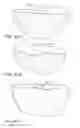 Fig. 79 - Patient-Adapted and Improved Orthopedic Implants, Designs and Related Tools