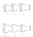 Fig. 85 - Patient-Adapted and Improved Orthopedic Implants, Designs and Related Tools