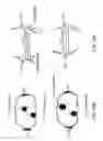 Fig. 89 - Patient-Adapted and Improved Orthopedic Implants, Designs and Related Tools