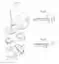 Fig. 06 - Tibial component