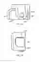 Fig. 09 - Arthoplasty revision system and method
